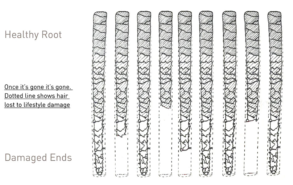 Hair Loss - Semantics and Misunderstandings